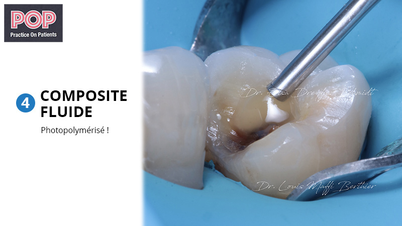 Figure article IDS POP.008