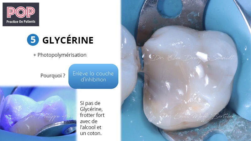 Figure article IDS POP.009