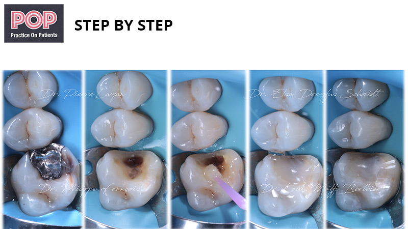 Figure article IDS POP.012