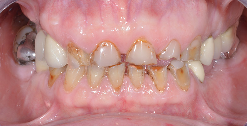 Figure-1-Formation-Damien-Savoure