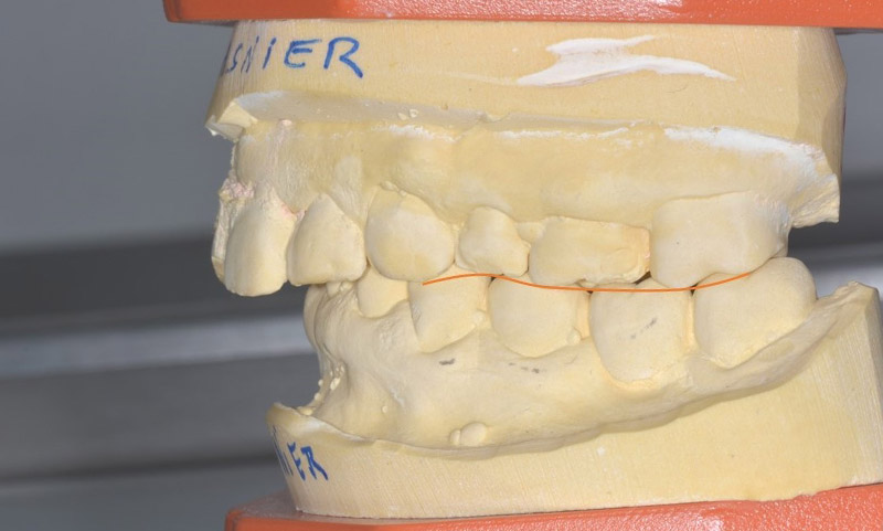 Fig.06-Formation-Damien-Savoure