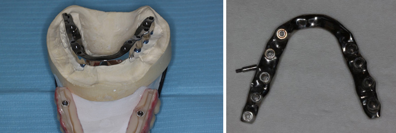 modèle de la barre et armature