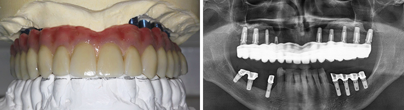 Modèle et radiographie