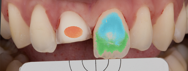 Indication du logiciel eLab