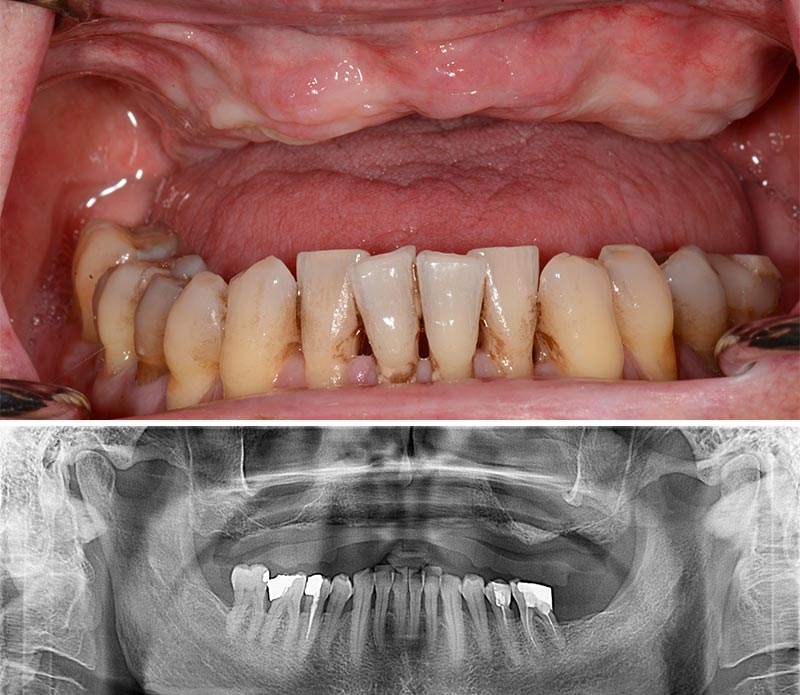 Anthogyr-Situation-initiale-Fig-1