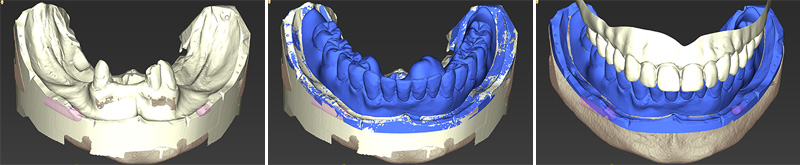 Rendu surfacique de la numérisation au format STL