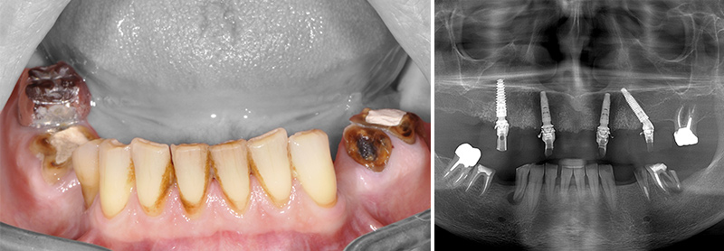 Présentation-second-cas