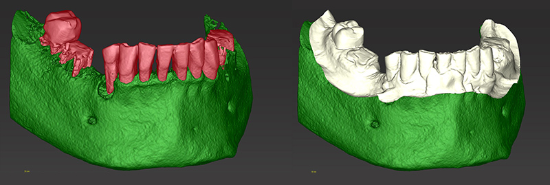 Présentation second cas