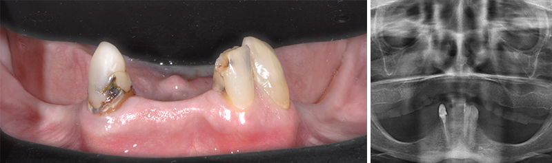 Examens clinique et radiologique