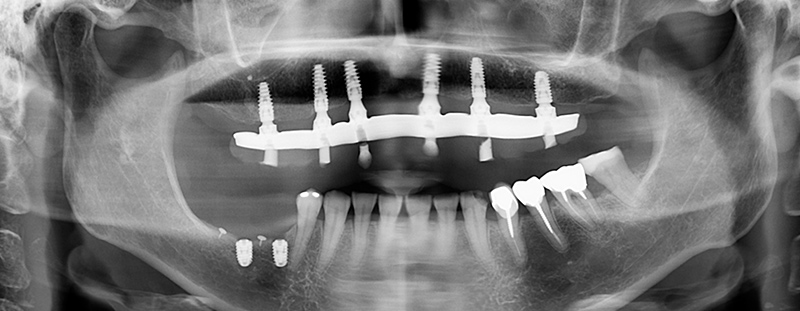 Radiographie-finale-16