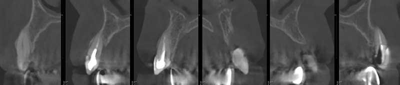 Scanner-pre-operatoire-6