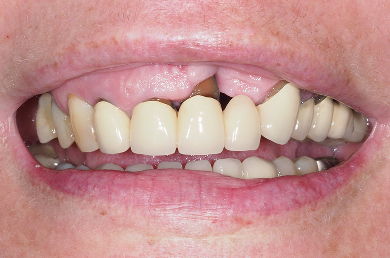 Situation-initiale-1