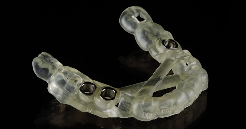 Guide-chirurgical-Imprimante-3D-Lanoiselée