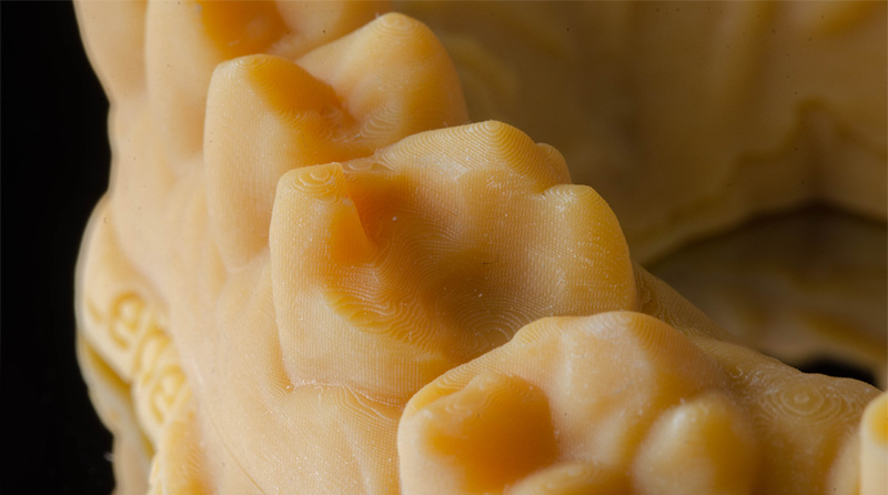 Modèle-Impression-3D-Lanoiselée