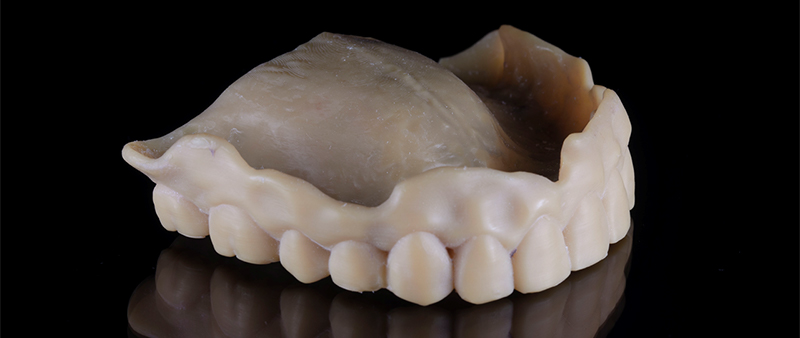 Prothese-Essai-Imprimante-3D-Lanoiselée