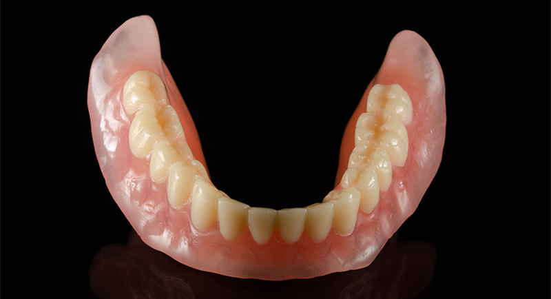 Prothèse-Résine-Impression-3D-Lanoiselée