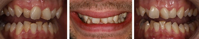 Article-alignement-Fig-1-Situation-initiale