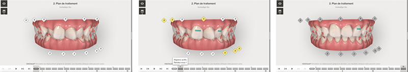 Article-alignement-Fig-3-Plan-traitement