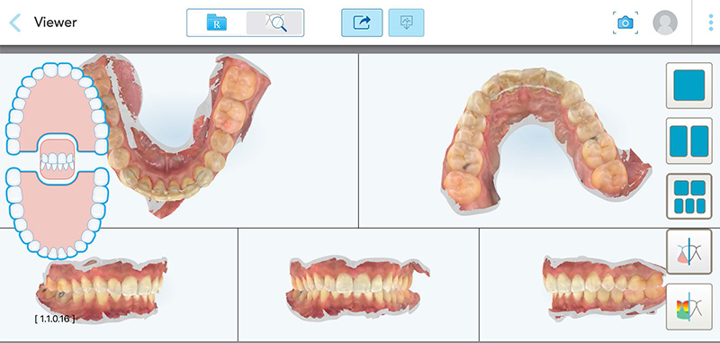 Article-alignement-Fig-5-Interface-ClinCheck