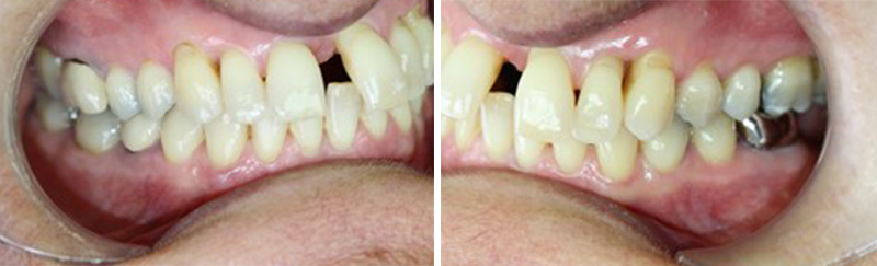 Situation-initiale-Fig-1