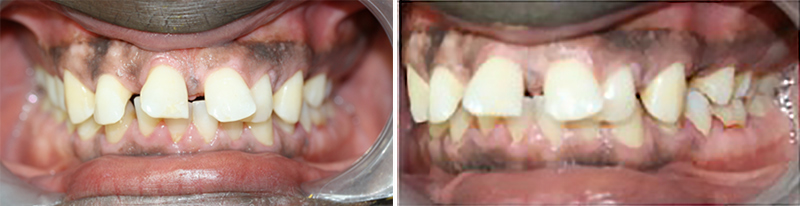 Situation-initiale-Fig-7