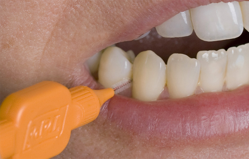 Image-brossettes-Tepe