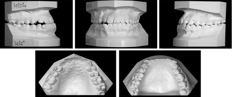Image-canine-inclusive-maxillaire-Espace-disponible