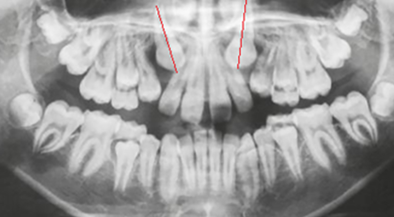 Image-Radio1-Olivier-Sandid