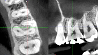 Alexandra-Minard-Image-3-CBCT