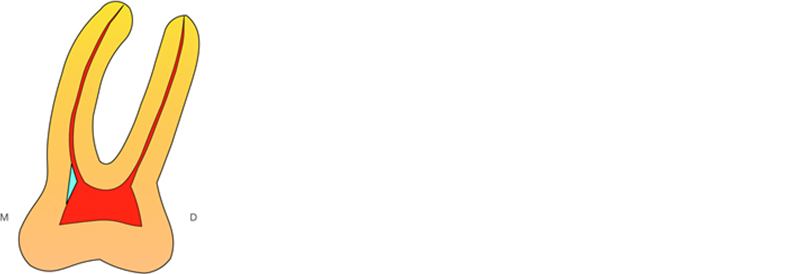 Figure-1-Triangle-Dentinaire-DE