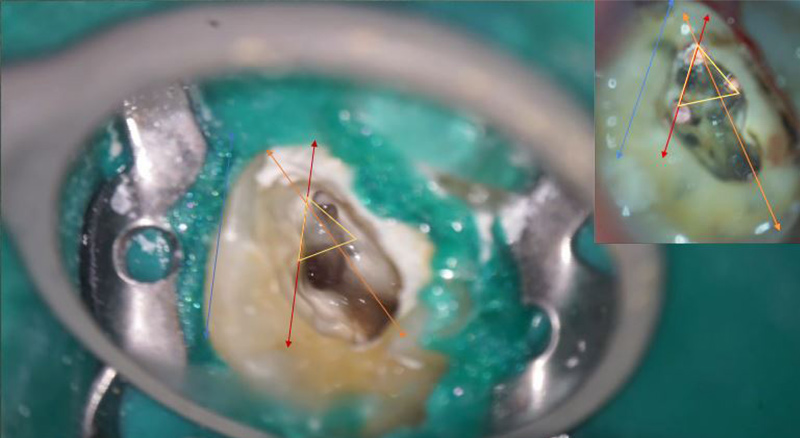 Geometrie-Trouver-le-MV2-BD