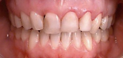 Fig-3-Debut-Traitement