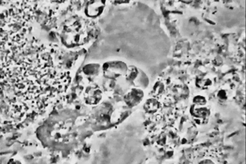 Fig-4-Biofilm-avant-traitement-2