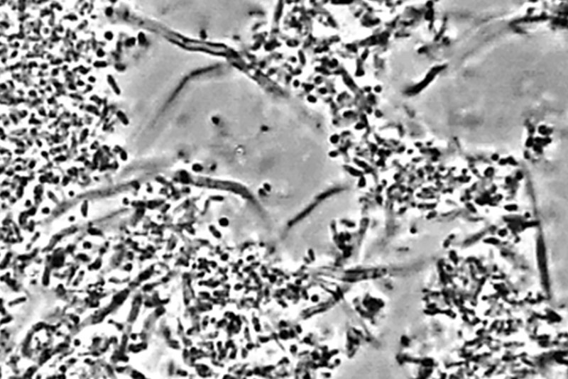 Fig-5-Biofilm-1-mois-apres-2
