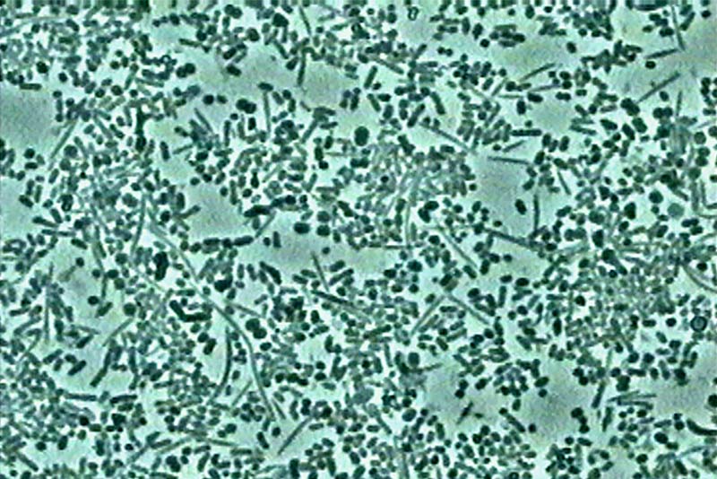 Fig-6-Biofilm-7-mois-apres-2