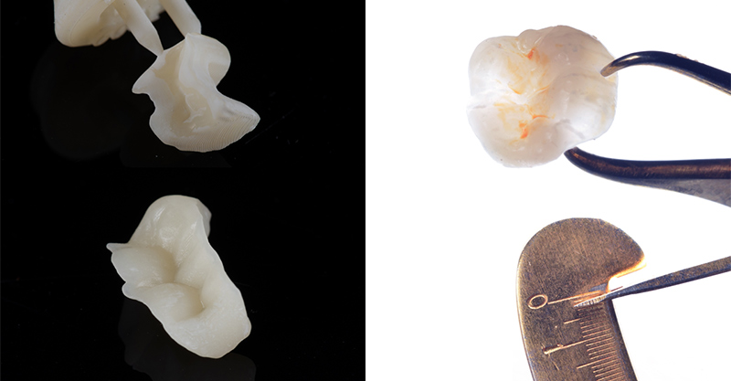 Fig-01-Edouard-Lanoiselee-Permanent-Crown