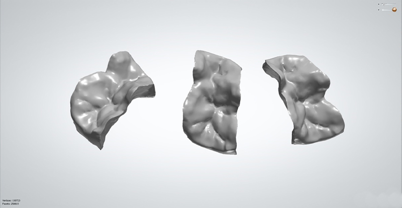 Fig-06_Permanent-Crown