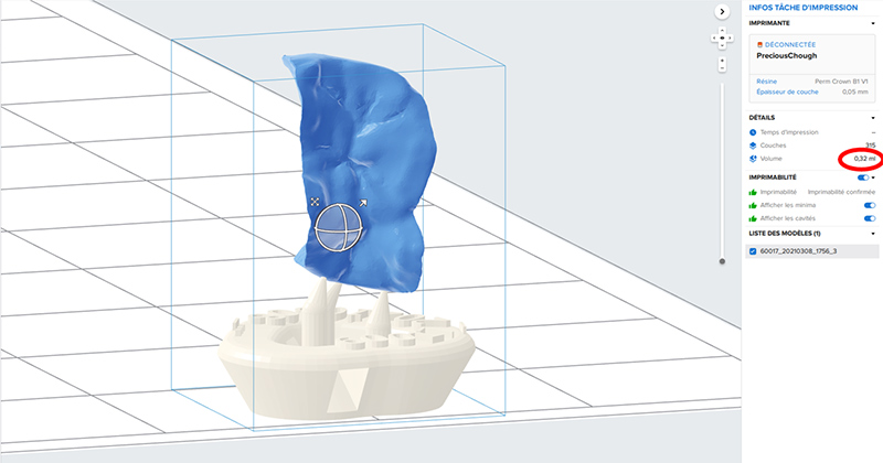 Fig-07_Permanent-Crown