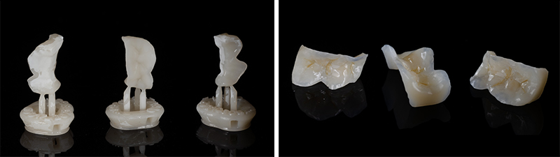 Fig-11_Permanent-Crown