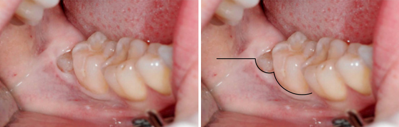 Image-Dents-de-sagesse-Philippakis