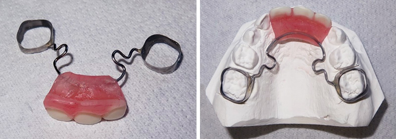 Cas clinique Marie Dacquin CPP 1