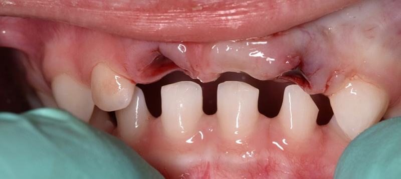 Situation initiale - Solution Marie Dacquin