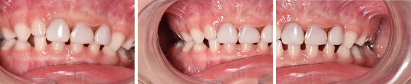 Résultat final solution CPP