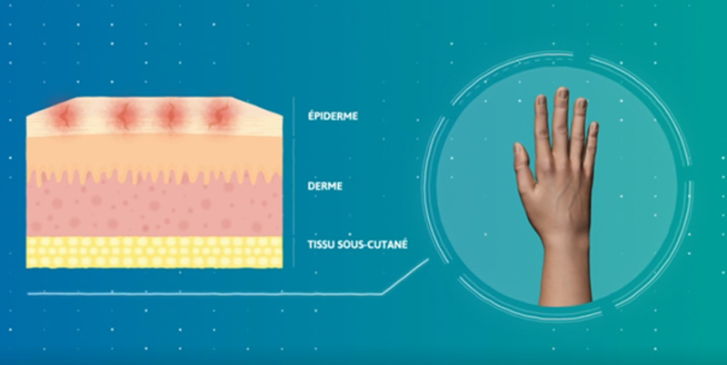 fig-03-ansell-dermatite