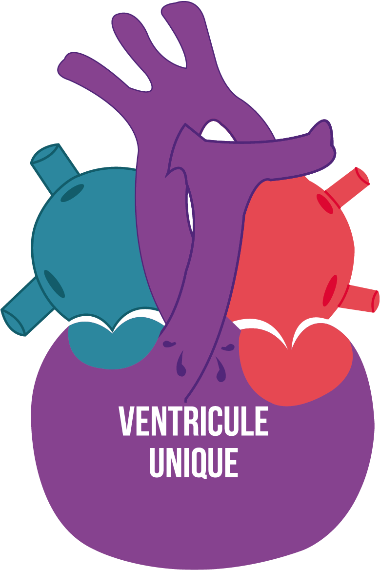 Figure10-article-cardiopathie-congenitale