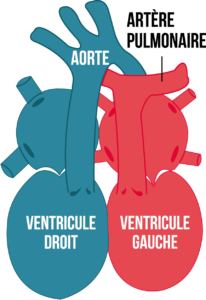 Figure7-article-cardiopathie-congenitale