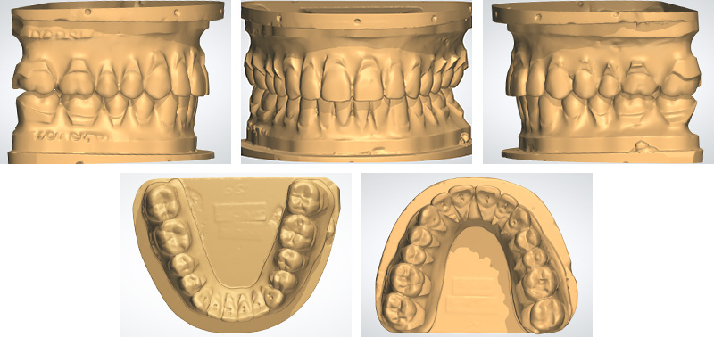 Photo-1-Article-Orthodontie-sur-mesure-Ons-Alouini