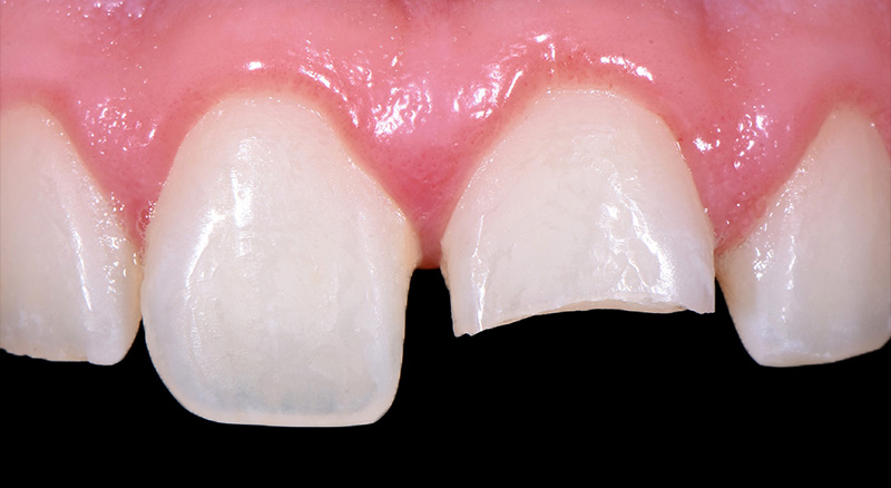 Photo-1-Article-Academie-du-sourire-Cas-A