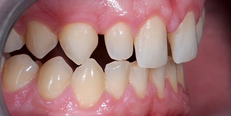 Photo-11-Article-Academie-du-sourire-Cas-C