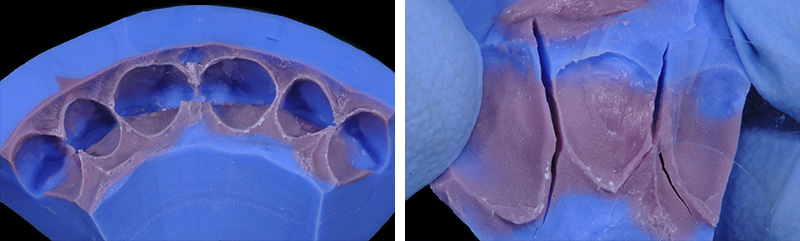 Photo-13-Article-Academie-du-sourire-Cas-C